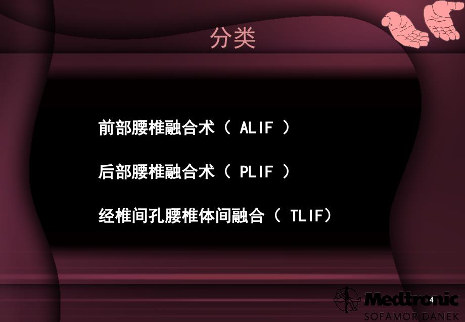 椎间融合技术 ppt课件.ppt_第4页