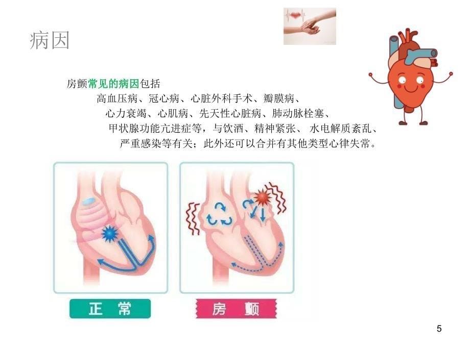 房颤健康教育ppt课件.ppt_第5页