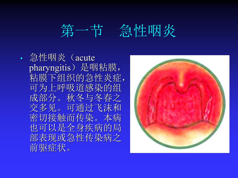 五官科常见疾病ppt课件.ppt_第4页