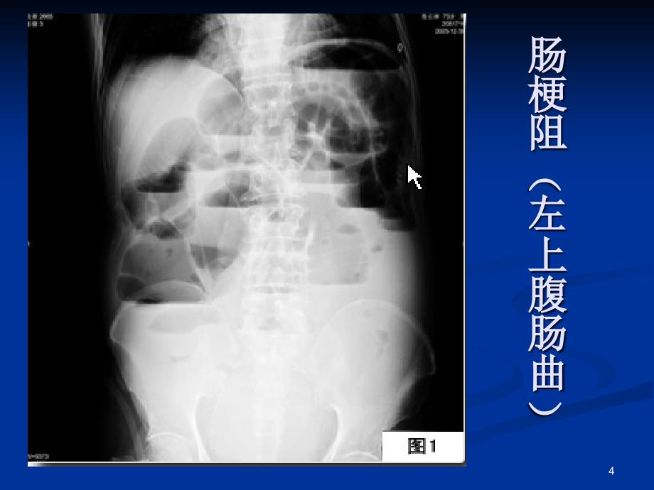 执业医师资格考试总结ppt课件.ppt_第4页