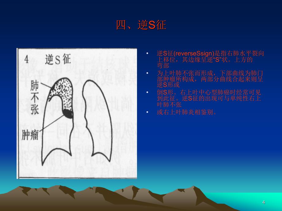 胸部X线征象ppt课件.ppt_第4页