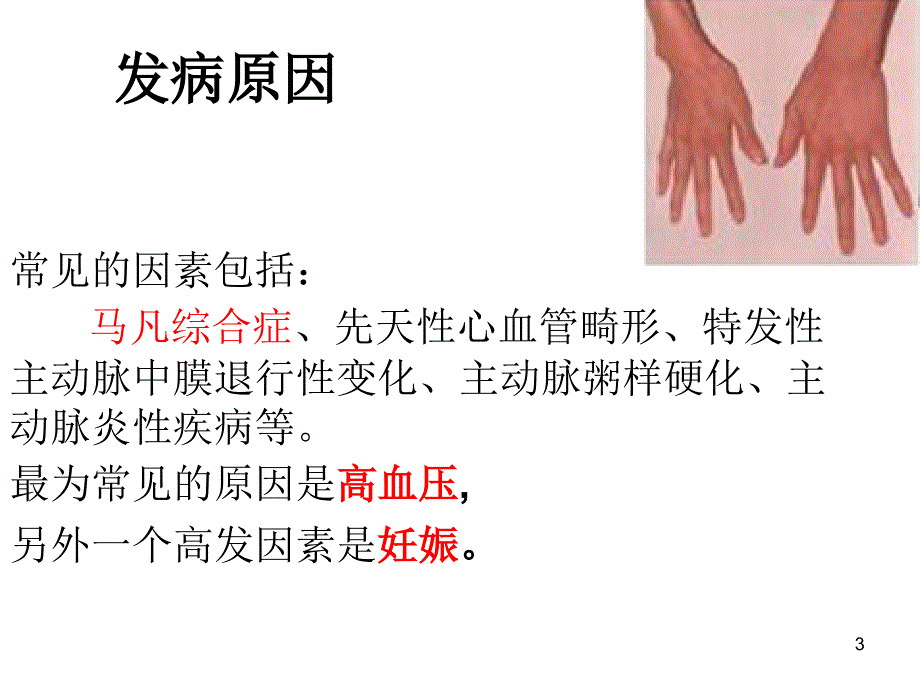 主动脉夹层动脉瘤教学查房讲座ppt课件.ppt_第3页