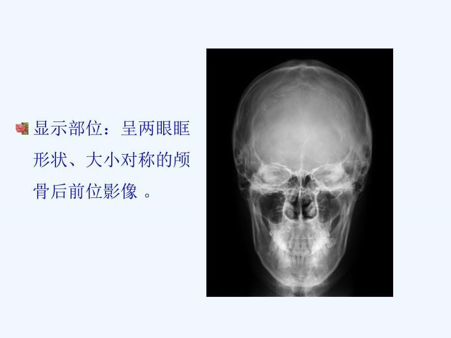 医学影像头颅摄影检查技术_第5页