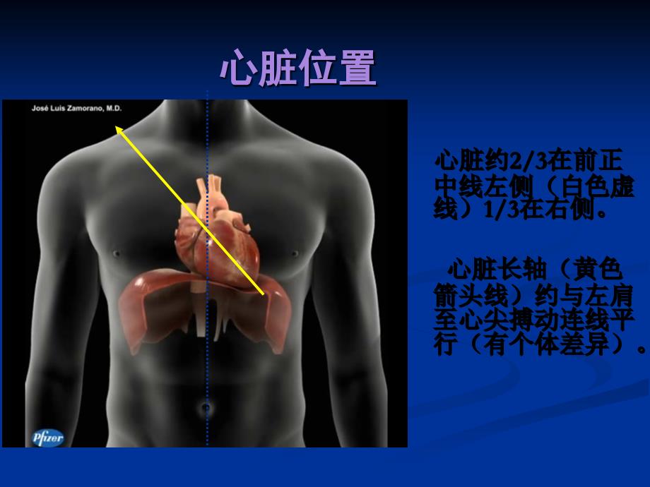 心脏重症超声PPT课件.ppt_第4页