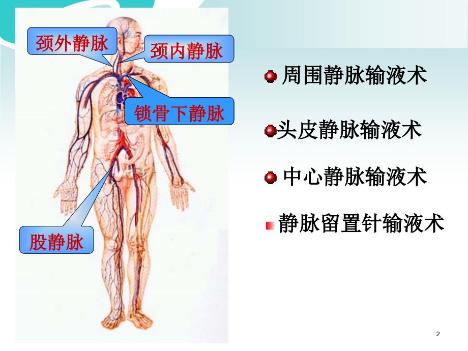 深静脉穿刺ppt课件.ppt_第2页