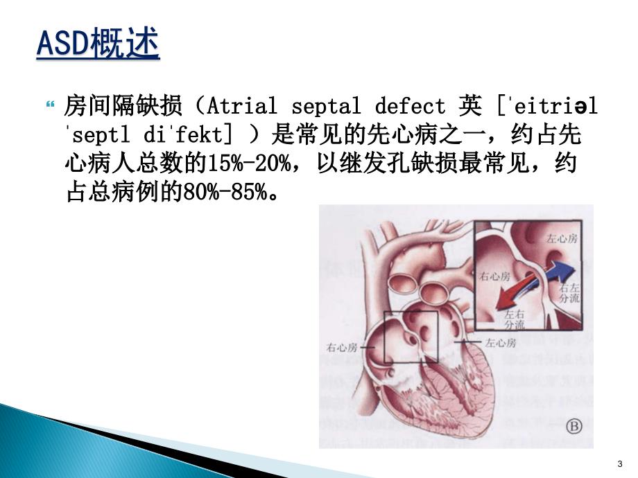 房间隔缺损封堵术的护理ppt课件.ppt_第3页