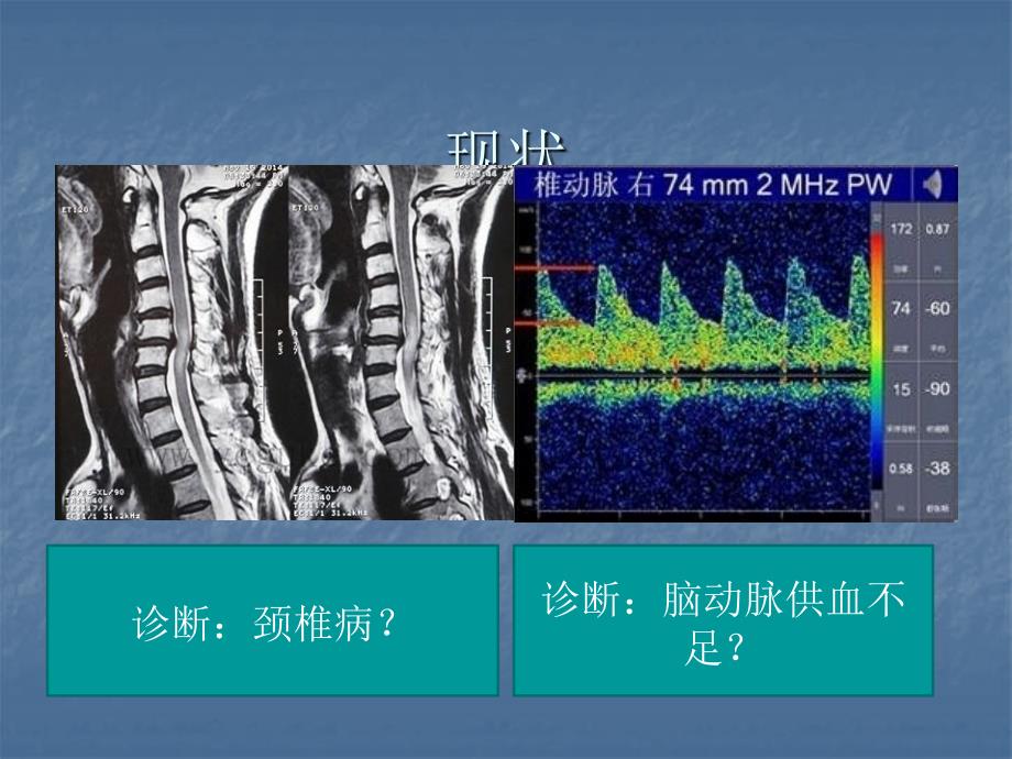 眩晕诊断 ppt课件.pptx_第4页