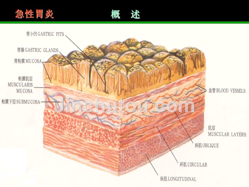 胃炎 刘冰熔.ppt_第3页