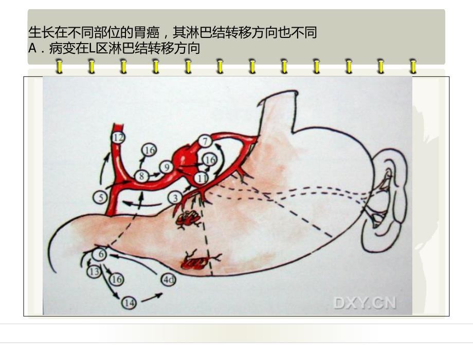 胃的淋巴引流.ppt_第4页