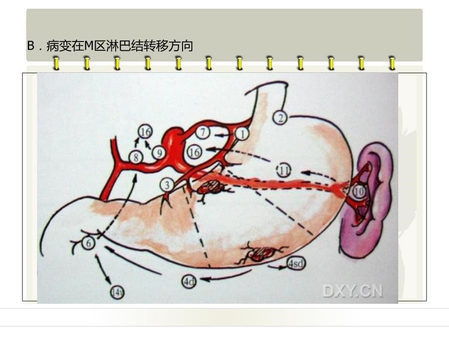 胃的淋巴引流.ppt_第5页