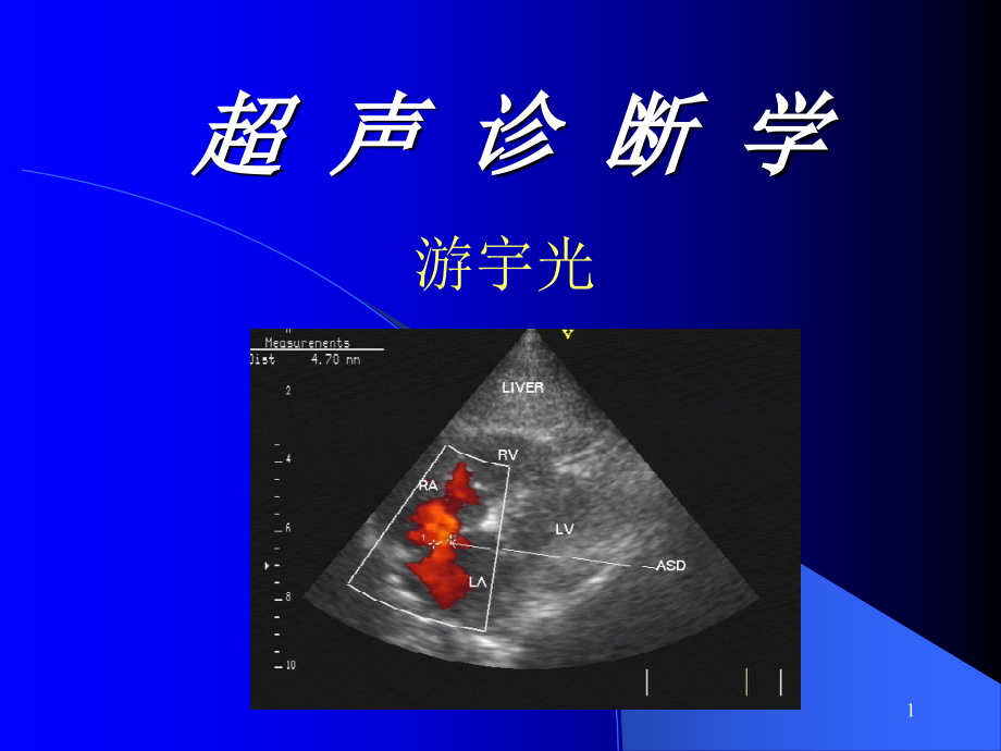 超声诊断学-02基础和原理 最新完整版本.ppt_第1页