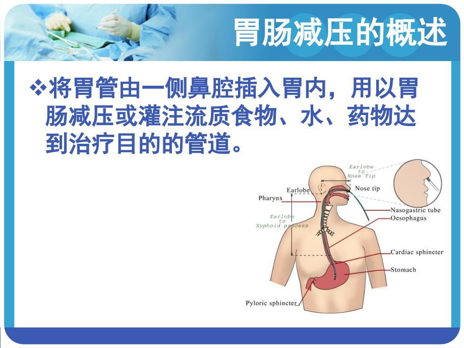 胃肠减压的护理完整版本.ppt_第4页