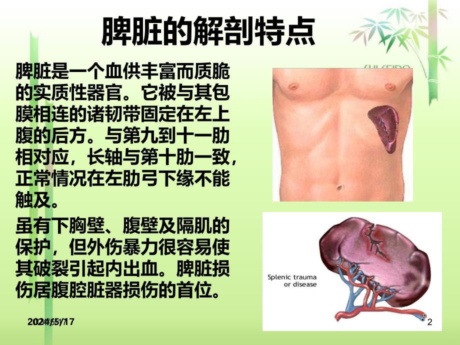 外伤性脾破裂的护理查房PPT课件.ppt_第2页