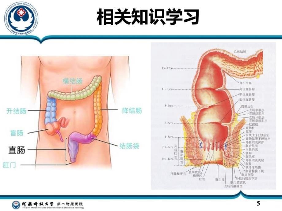 大肠癌PPT课件.ppt_第5页