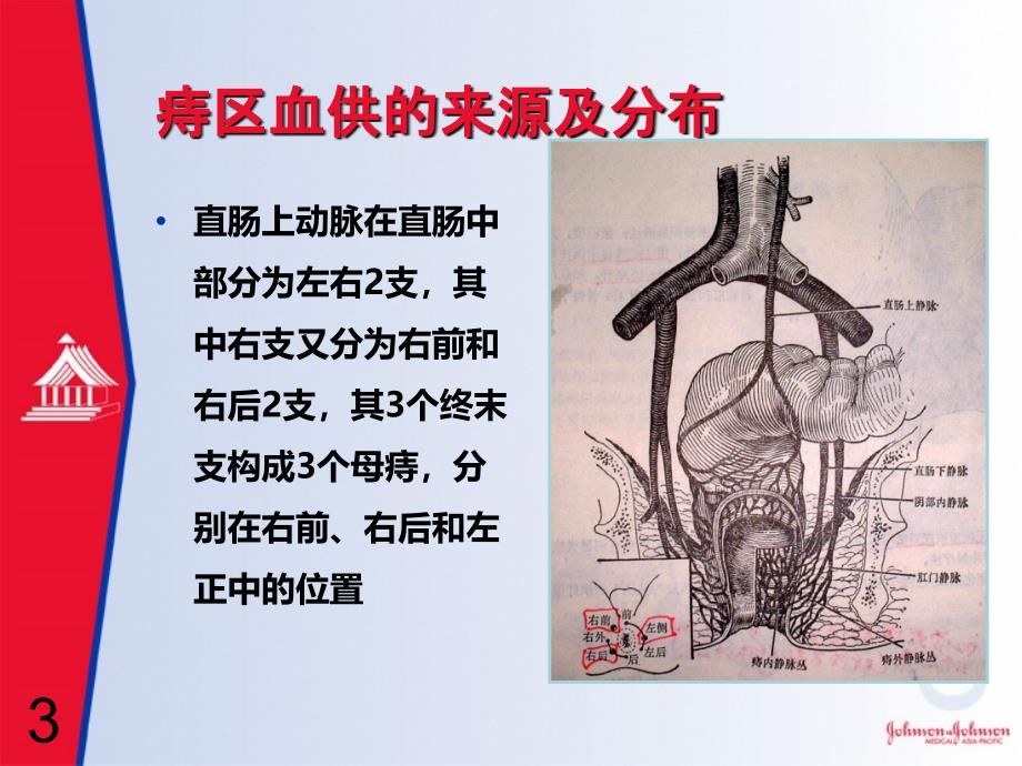 PPH手术PPT课件.ppt_第3页