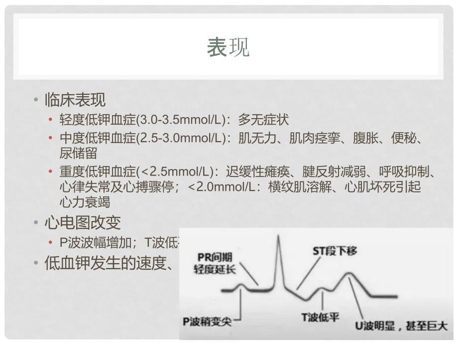 低钾血症16616PPT课件.ppt_第5页