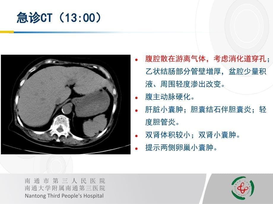 一例复杂腹腔感染的诊治体会PPT课件.ppt_第5页