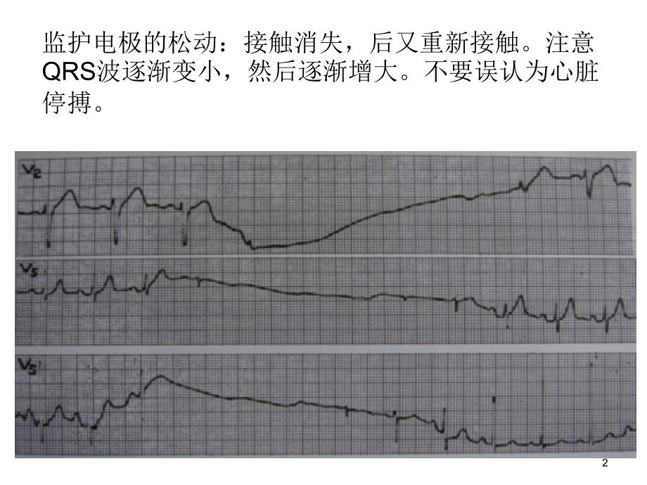 如何认识心电图PPT课件.ppt_第2页