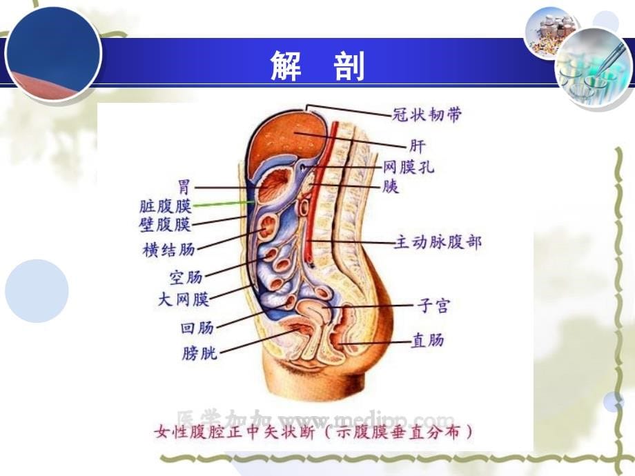 急性腹膜炎病人的护理完整版本.ppt_第5页