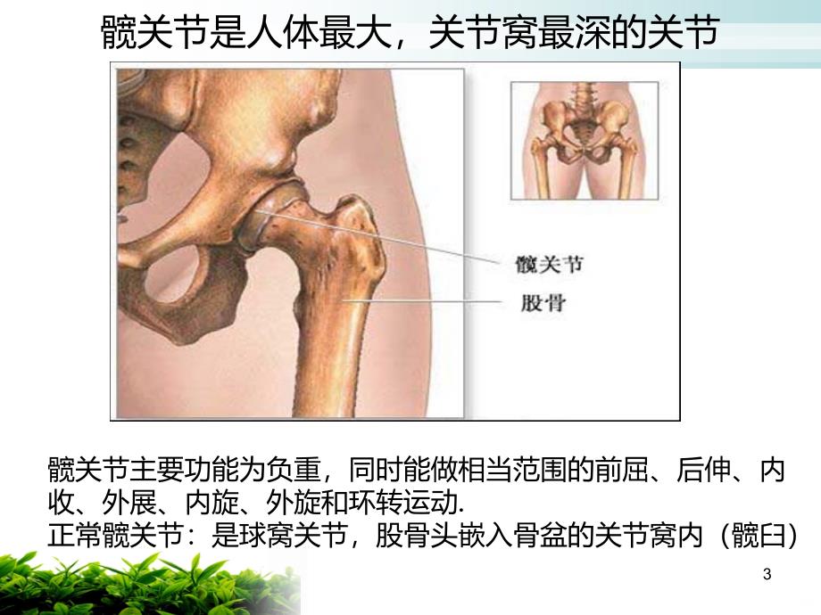 人工髋关节置换术后的护理PPT课件.ppt_第3页