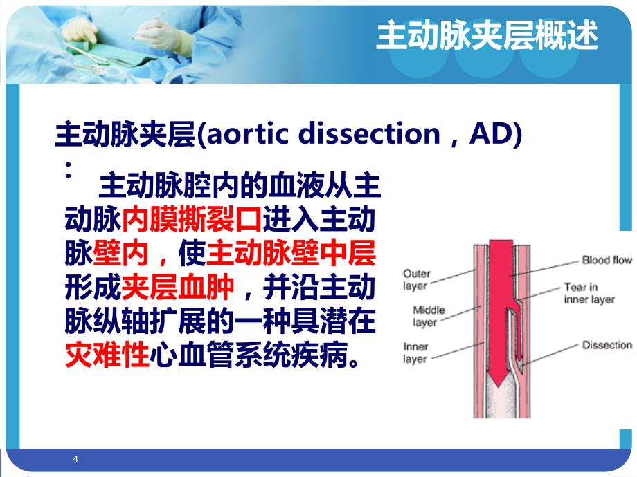 主动脉夹层的护理查房PPT课件.ppt_第4页