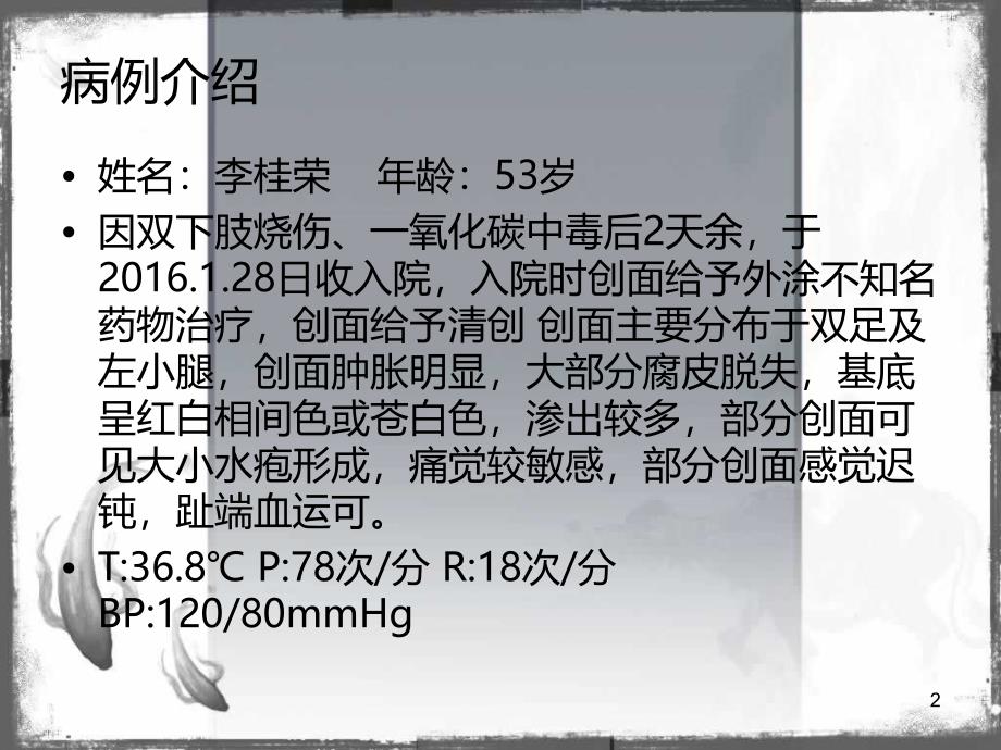 双下肢烧伤护理--张瑞雪PPT课件.ppt_第2页