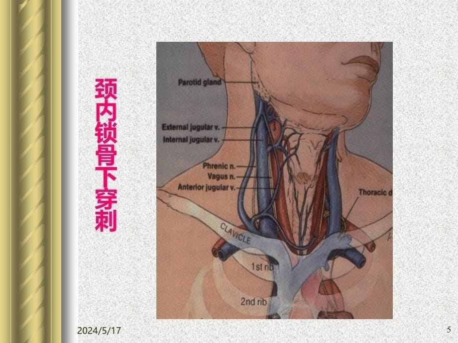 名师推荐外周中心静脉导管PPT课件.ppt_第5页