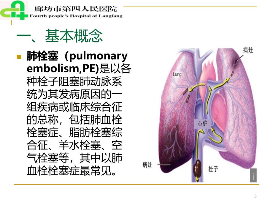 肺栓塞患者的护理PPT课件.ppt_第3页