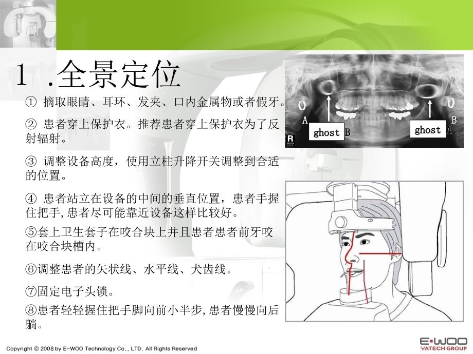 牙片机拍摄程序定位ppt课件.ppt_第2页