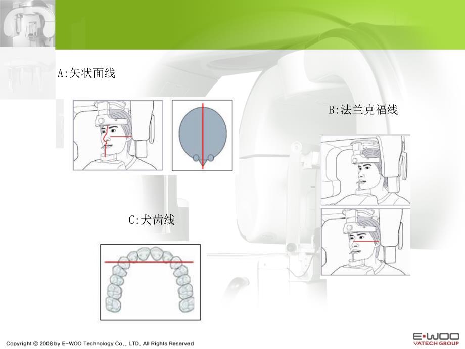 牙片机拍摄程序定位ppt课件.ppt_第3页