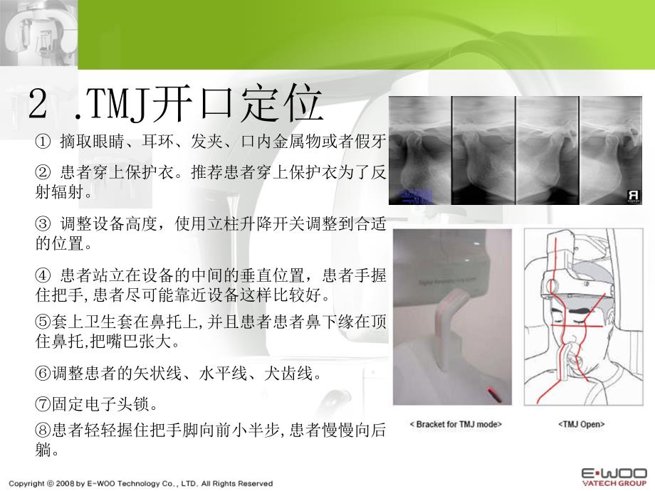 牙片机拍摄程序定位ppt课件.ppt_第4页