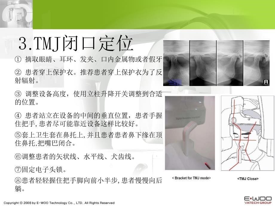 牙片机拍摄程序定位ppt课件.ppt_第5页