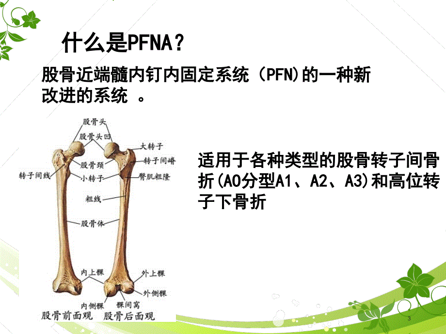 PFNA髓内钉手术配合护理查房ppt课件.ppt_第3页