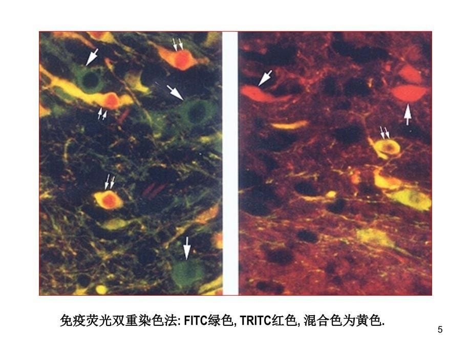 免疫组化双重染色技术ppt课件.ppt_第5页