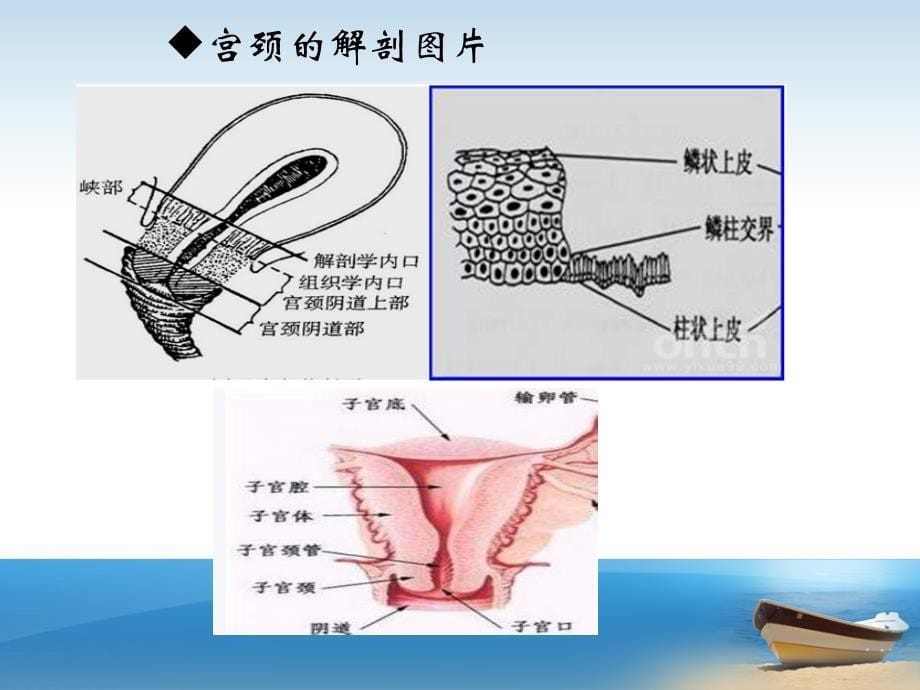 宫颈癌防治知识ppt课件.ppt_第5页