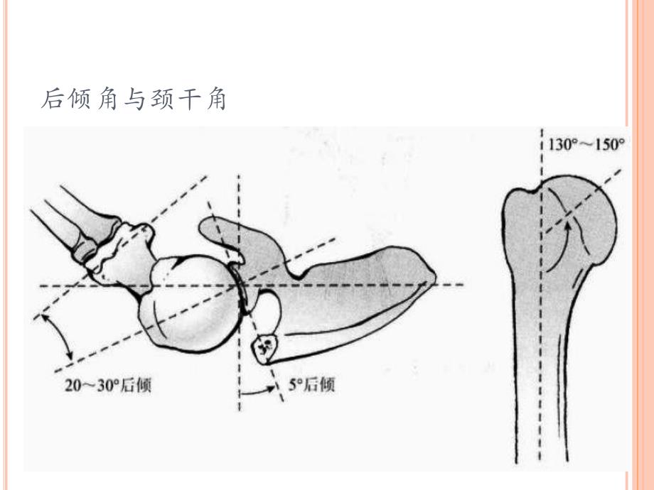 肱骨近端骨折教案ppt课件.ppt_第4页