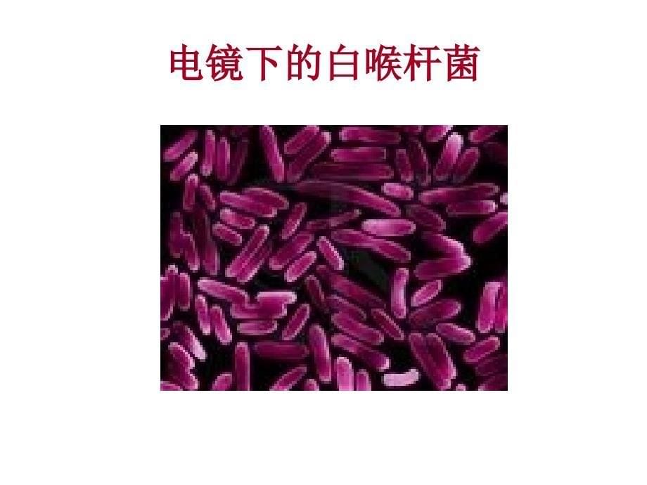 微生物革兰阳性需氧和兼性厌氧杆菌ppt课件.ppt_第5页