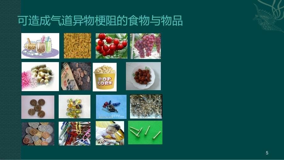 气道异物梗阻的急救处理ppt课件.ppt_第5页