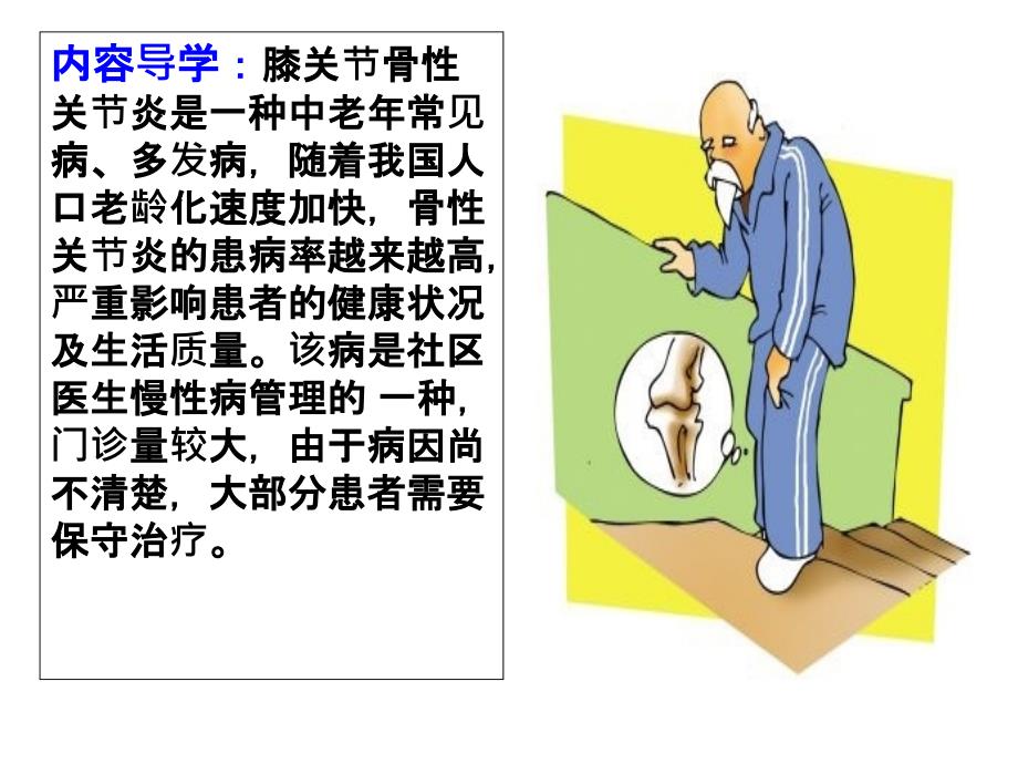 膝关节骨性关节炎 (3)ppt课件.ppt_第2页