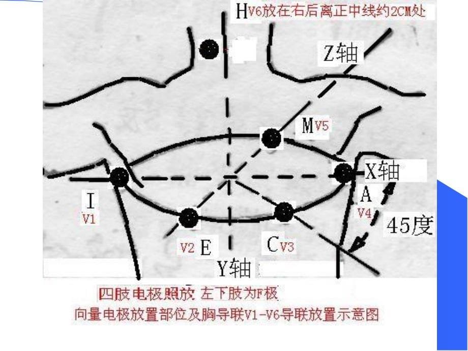 心电图心电向量图图解ppt课件.ppt_第5页