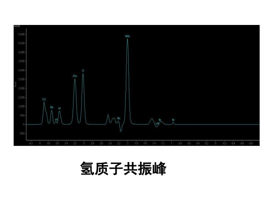 脑外DWIMRS临床及原理ppt课件.ppt_第5页