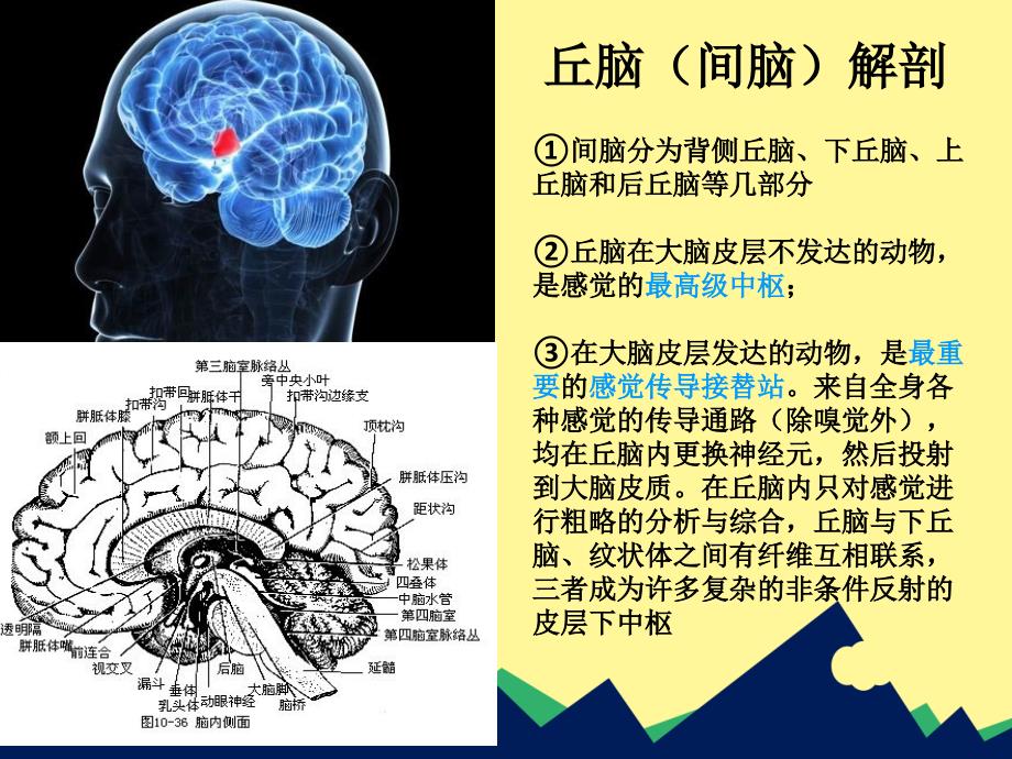 丘脑出血护理ppt课件.ppt_第3页