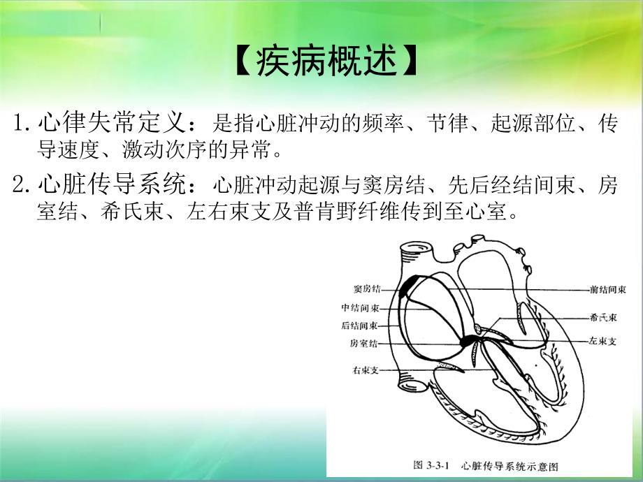 心律失常病人的护理查房ppt课件.ppt_第2页