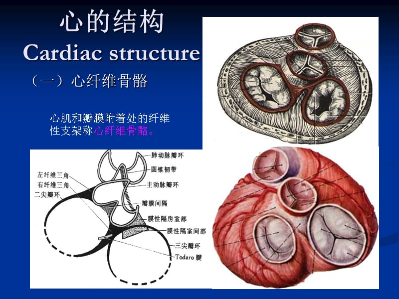 心脏肿瘤CT诊断ppt课件.ppt_第3页