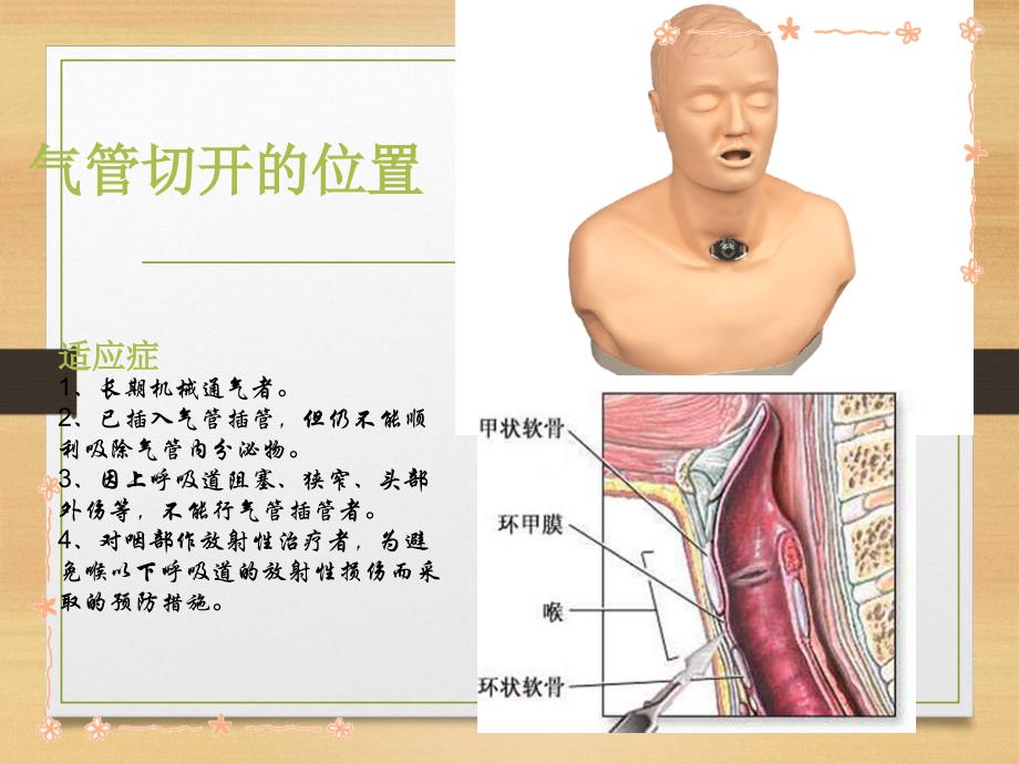 气切护理 .pptppt课件.ppt_第4页