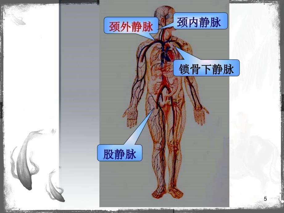 血管内导管相关性感染预防指南解读ppt课件.ppt_第5页