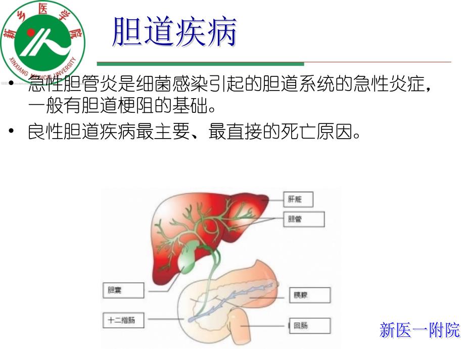 AOSC-急性梗阻化脓性胆管炎.ppt_第2页