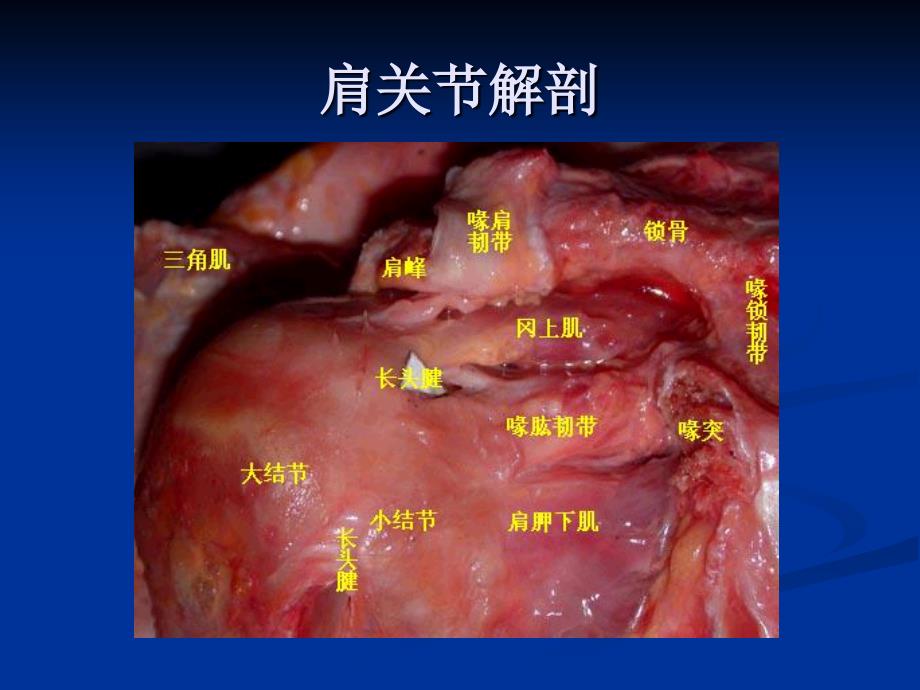 《肩关节MRI》PPT课件.ppt_第4页