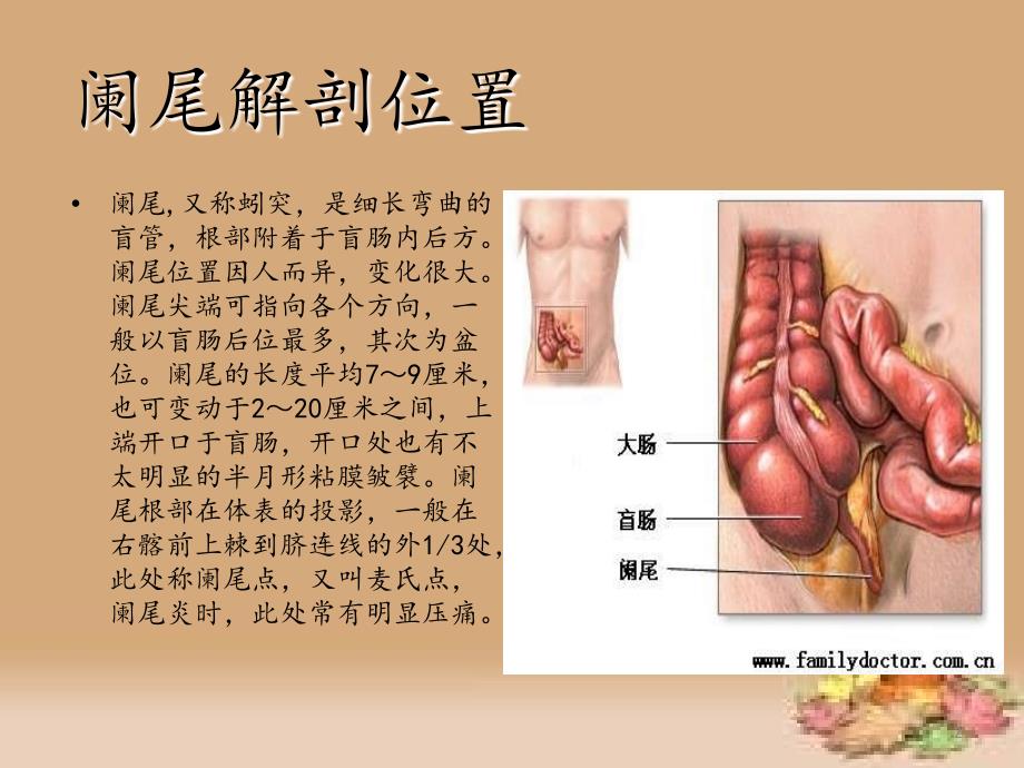 阑尾切除术的手术配合PPT幻灯片.ppt_第2页