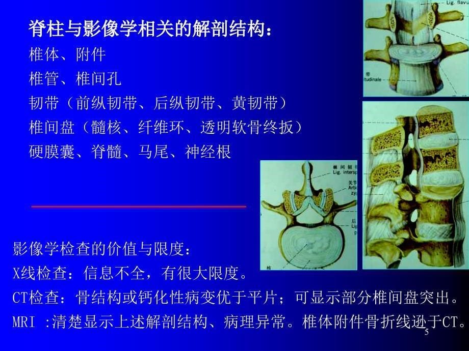 （推荐精选）脊柱MR解剖与脊髓常见疾病.ppt_第5页